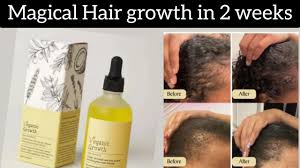 Hair Growth Oil