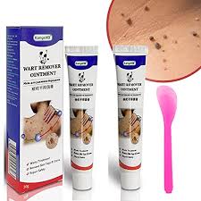 Warts Remover