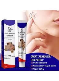 Warts Remover