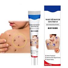 Warts Remover
