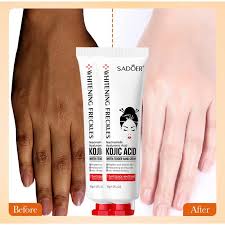 Sadoer - Kojic Acid Hand Cream